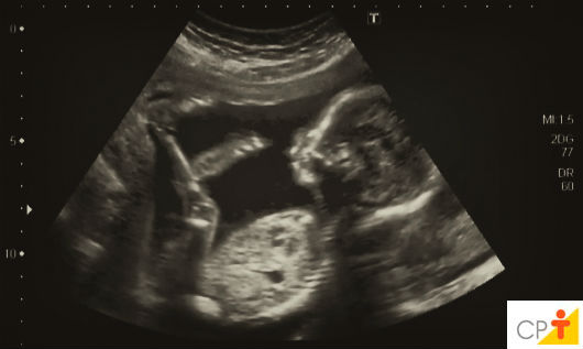 Especial Gravidez: 28ª semana de gestação - do 190º ao 196º dia ultrassonografia fetal
