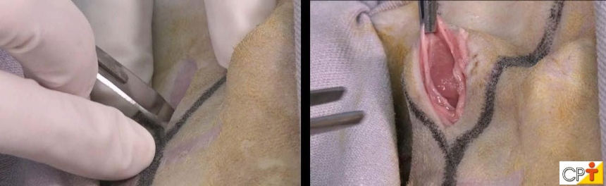 Incisão em pele e exposição da glândula respectivamente Artigos CPT Incisão em pele e exposição da glândula respectivamente Artigos CPT