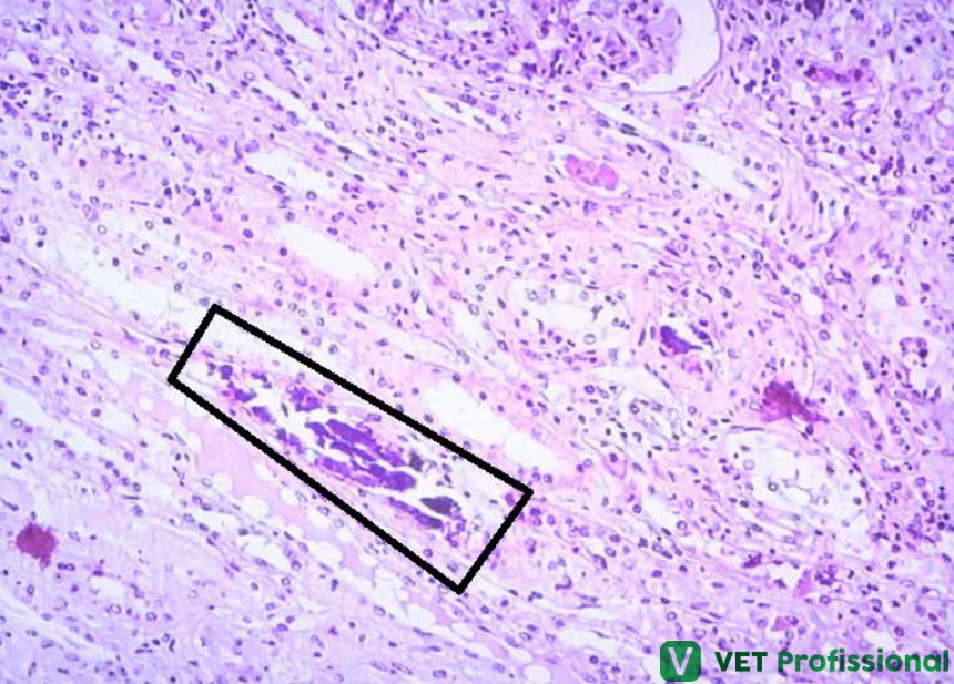 O Que Significa Ausência De Calcificação Patológica - RETOEDU