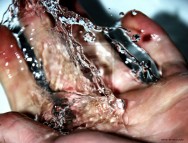 primeiros socorros Resfrie a área queimada, colocando-a sob água corrente de torneira ou soro fisiológico ou ponha e tire um tecido umedecido com água fria